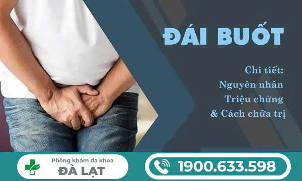 Hình ảnh minh họa